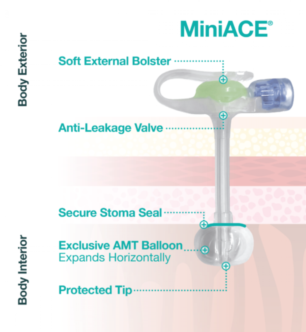 imagem Botão MiniACE