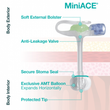 imagem Botão MiniACE